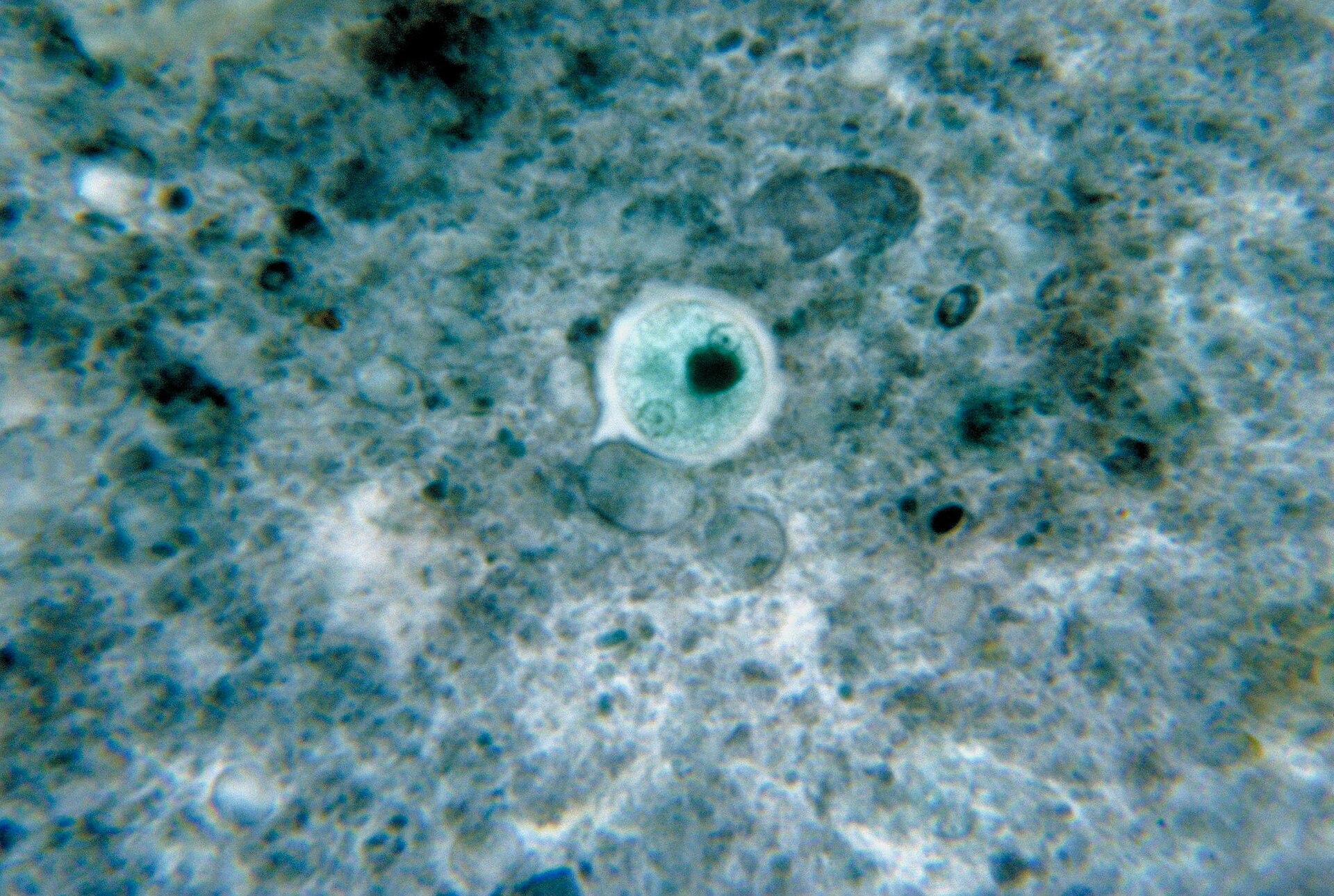Imagem de referência de protozoário, descrito nos dados abertos como microorganismos eucarióticos unicelulares e heterotróficos