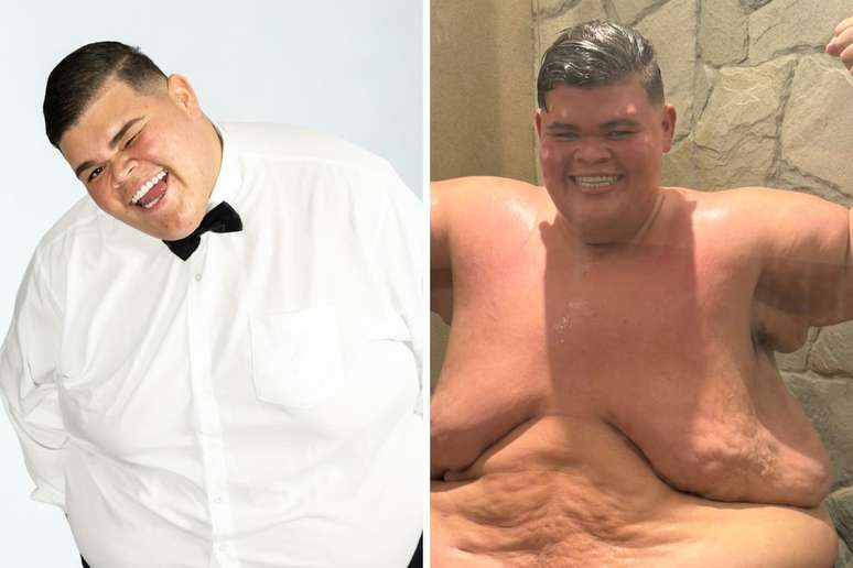 Gordão da XJ é internado às pressas após apresentar sangramento íntimo: 'Susto enorme'