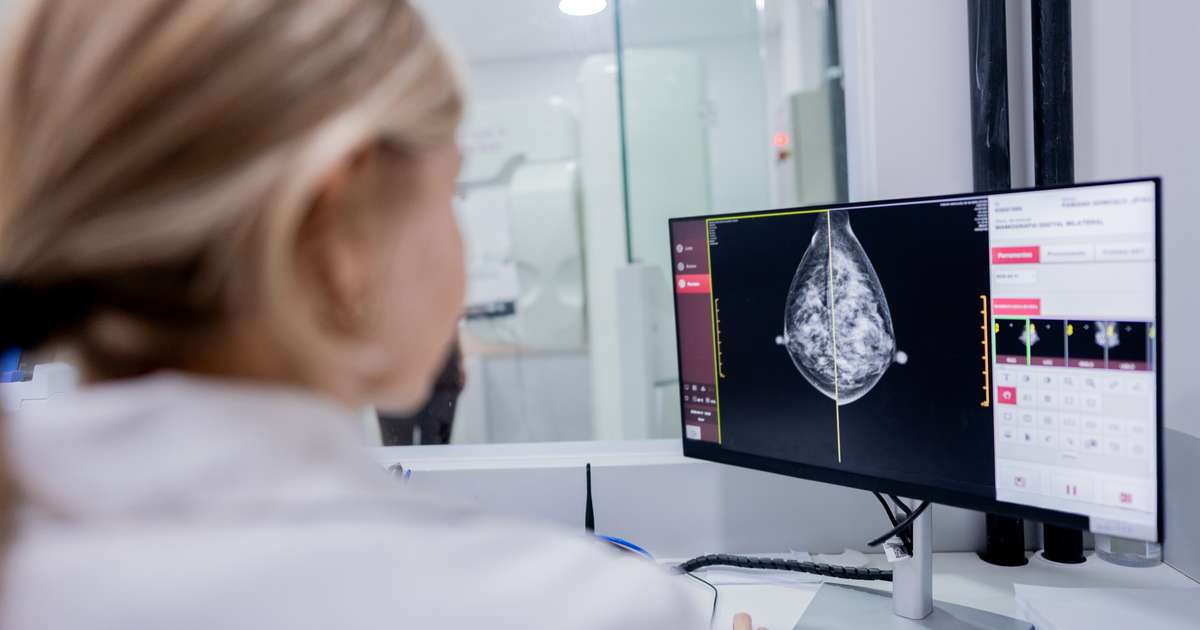 IA pode ajudar a detectar melhor câncer de mama? Estudos no Brasil tentam descobrir